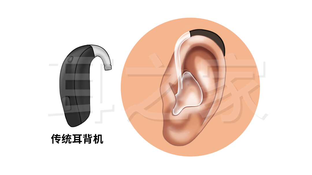 耳之家1.png